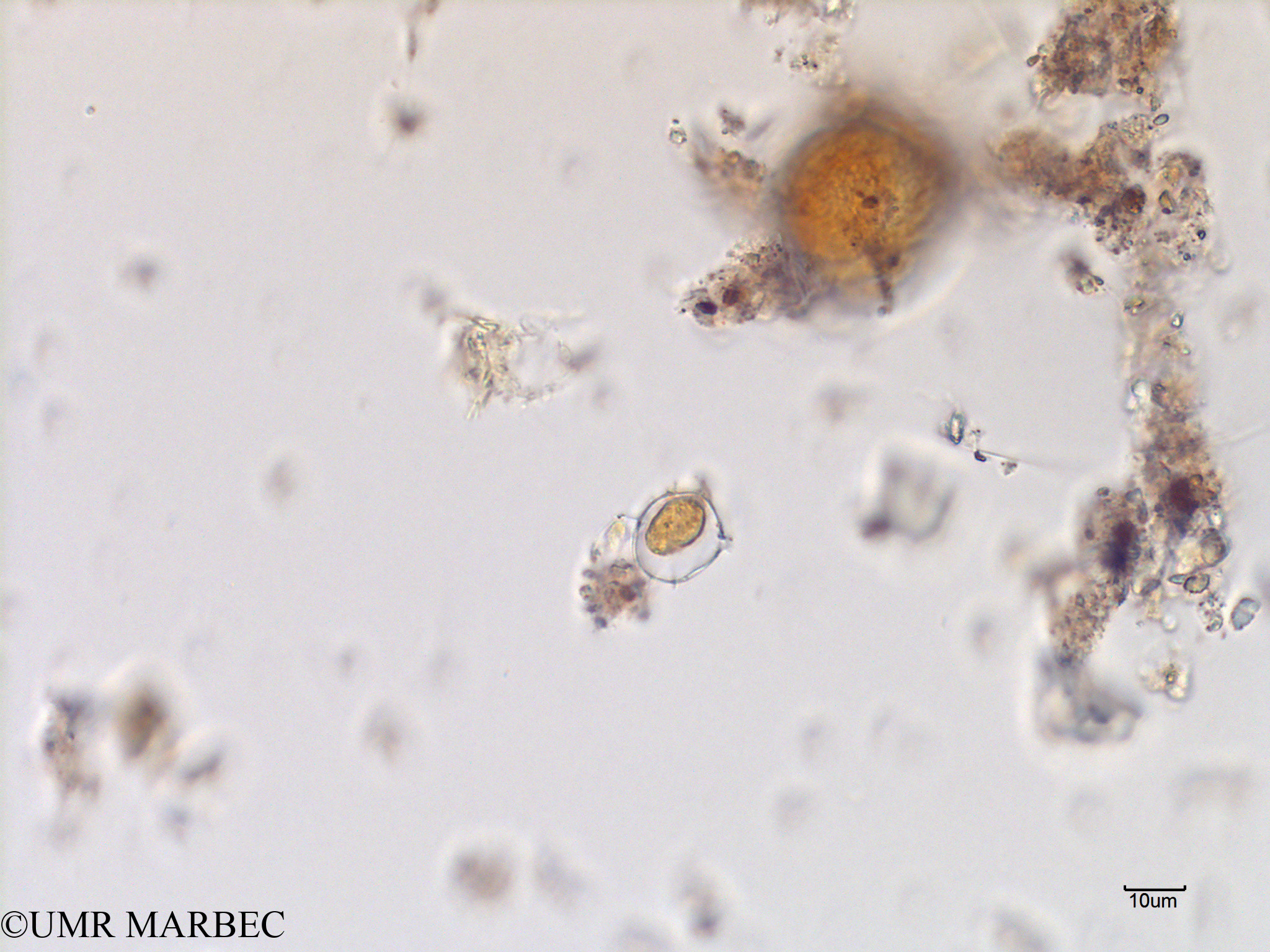 phyto/Scattered_Islands/mayotte_lagoon/SIREME May 2016/Protoperidinium cerasus (old P. pyriforme -MAY4_proto lequel-4).tif(copy).jpg